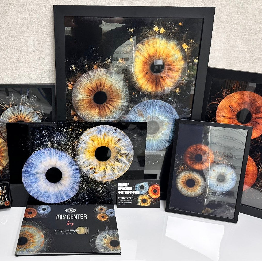 Очите, уловени като изкуство.  Ирисова фотография Русе